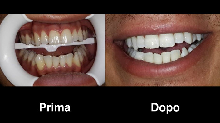 dentisti-albania