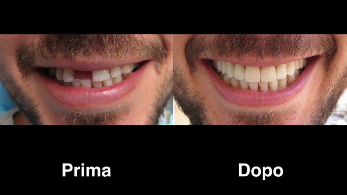 dentisti-albania