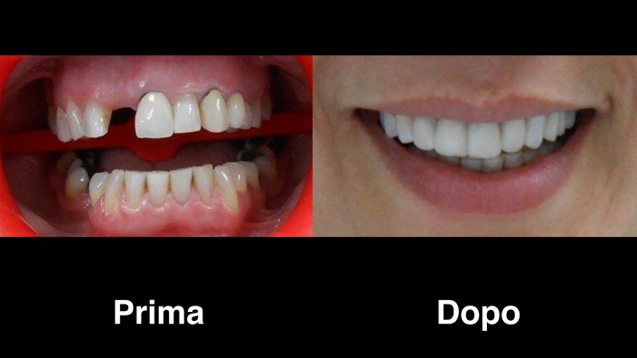 dentisti-albania