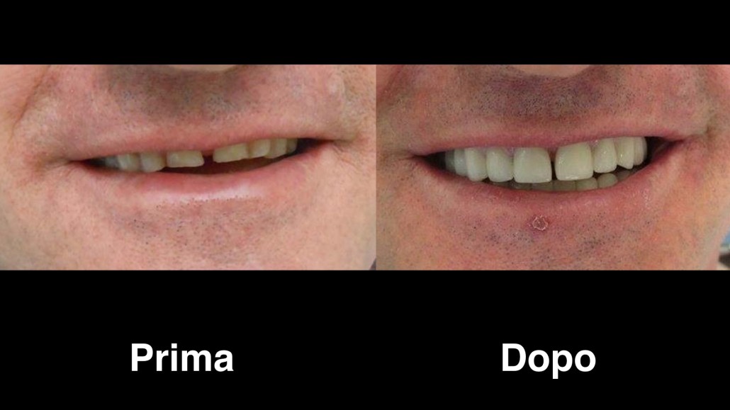 dentisti-albania