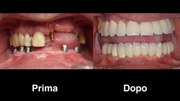 dentisti-albania