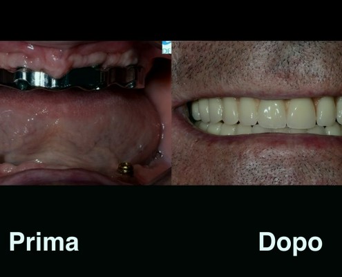 dentisti-croazia
