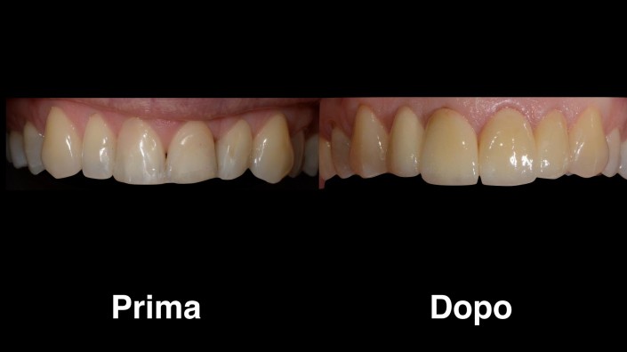 dentisti-croazia