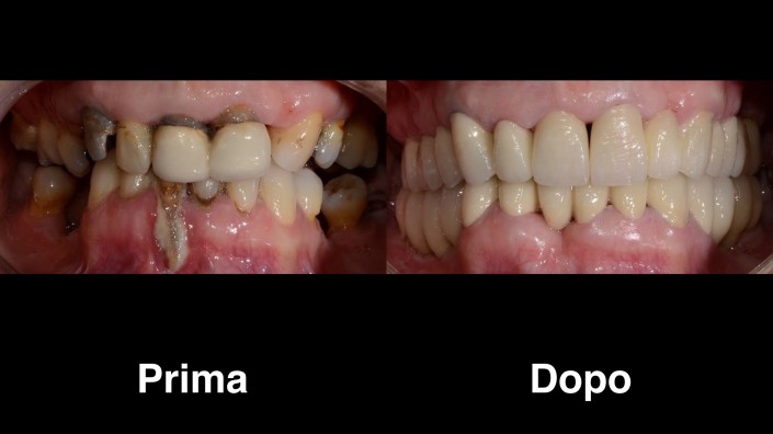 dentisti-croazia