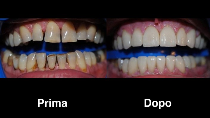 dentisti-croazia