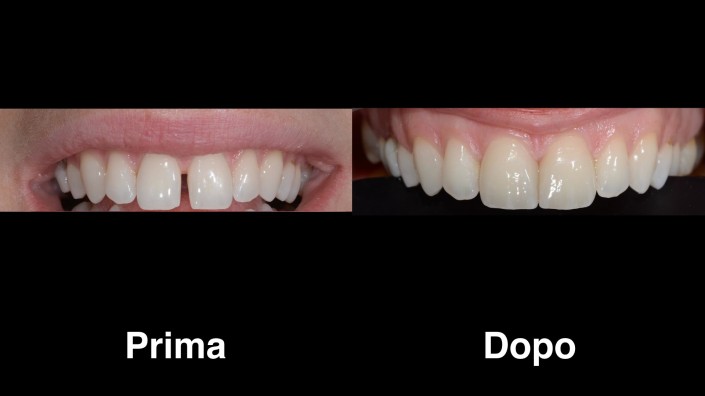 dentisti-croazia