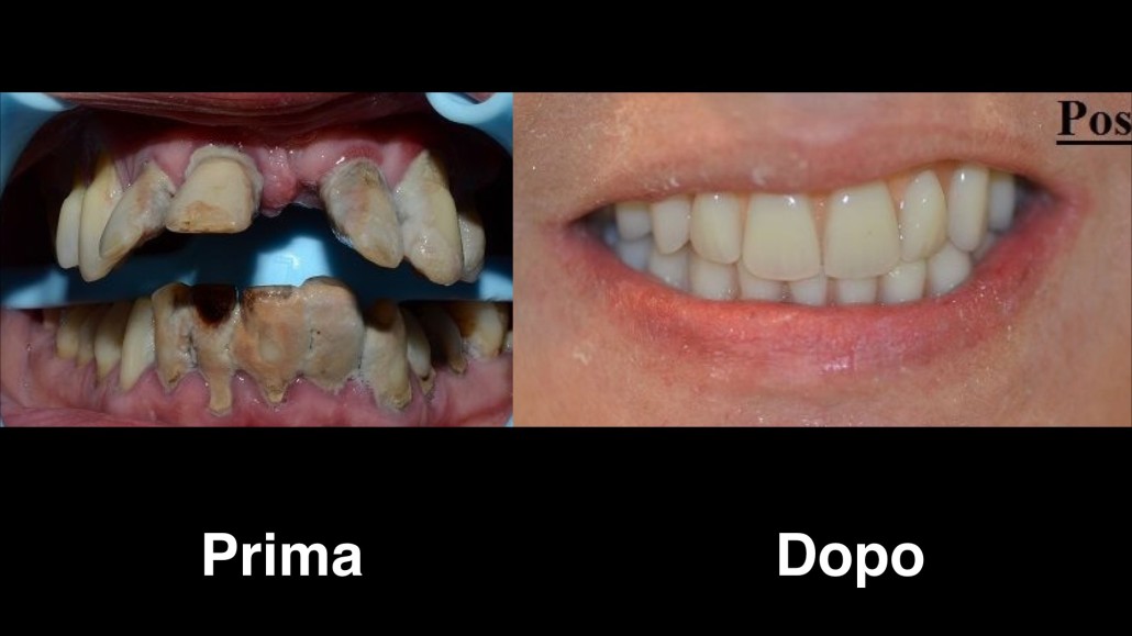 dentisti-croazia