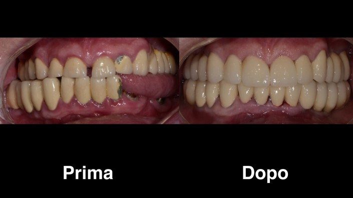 dentisti-croazia