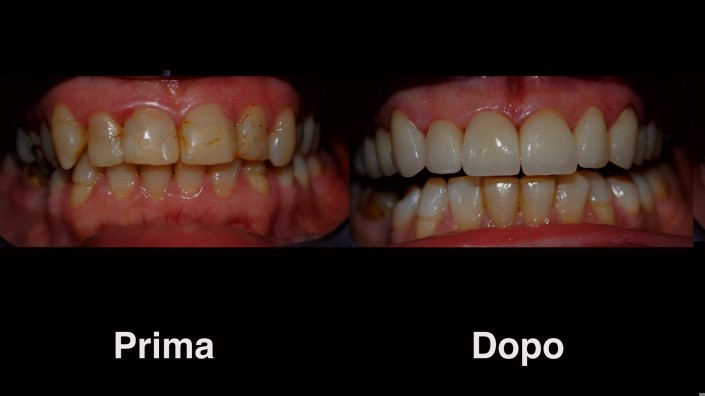 dentisti-croazia