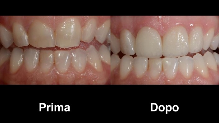 dentisti-croazia