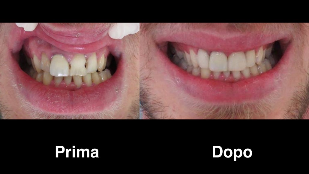 dentisi-albania
