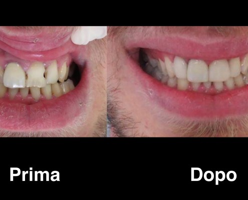 dentisi-albania