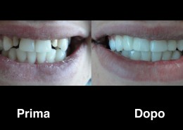 dentisti-albania