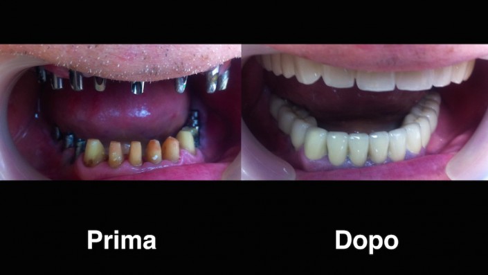 dentisti-moldavia