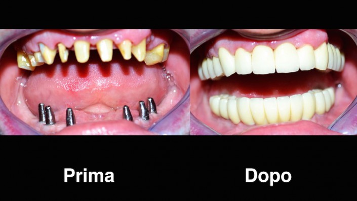 dentisti-moldavia