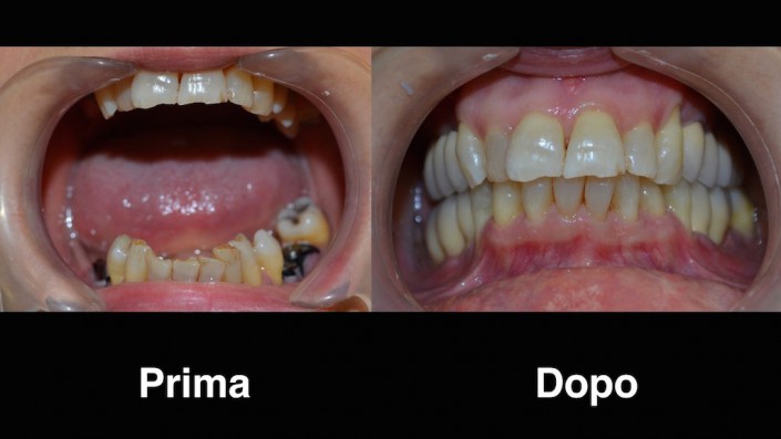 dentisti-moldavia